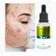 Sérum facial Bioativo antiacne 10x1 Max Love 